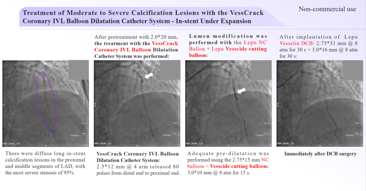 Clinical case presentation Case 1