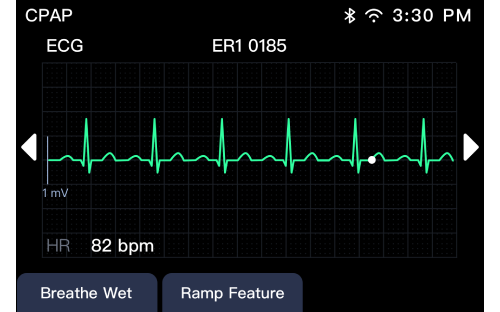 datatypefor datafanyifanyiPengaturan ECG